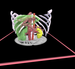 Realize Medical, creators of Elucis, an all-in-one virtual reality platform for medical modeling, visualization and remote collaboration, announces their first in-person exhibit at RSNA in Chicago
